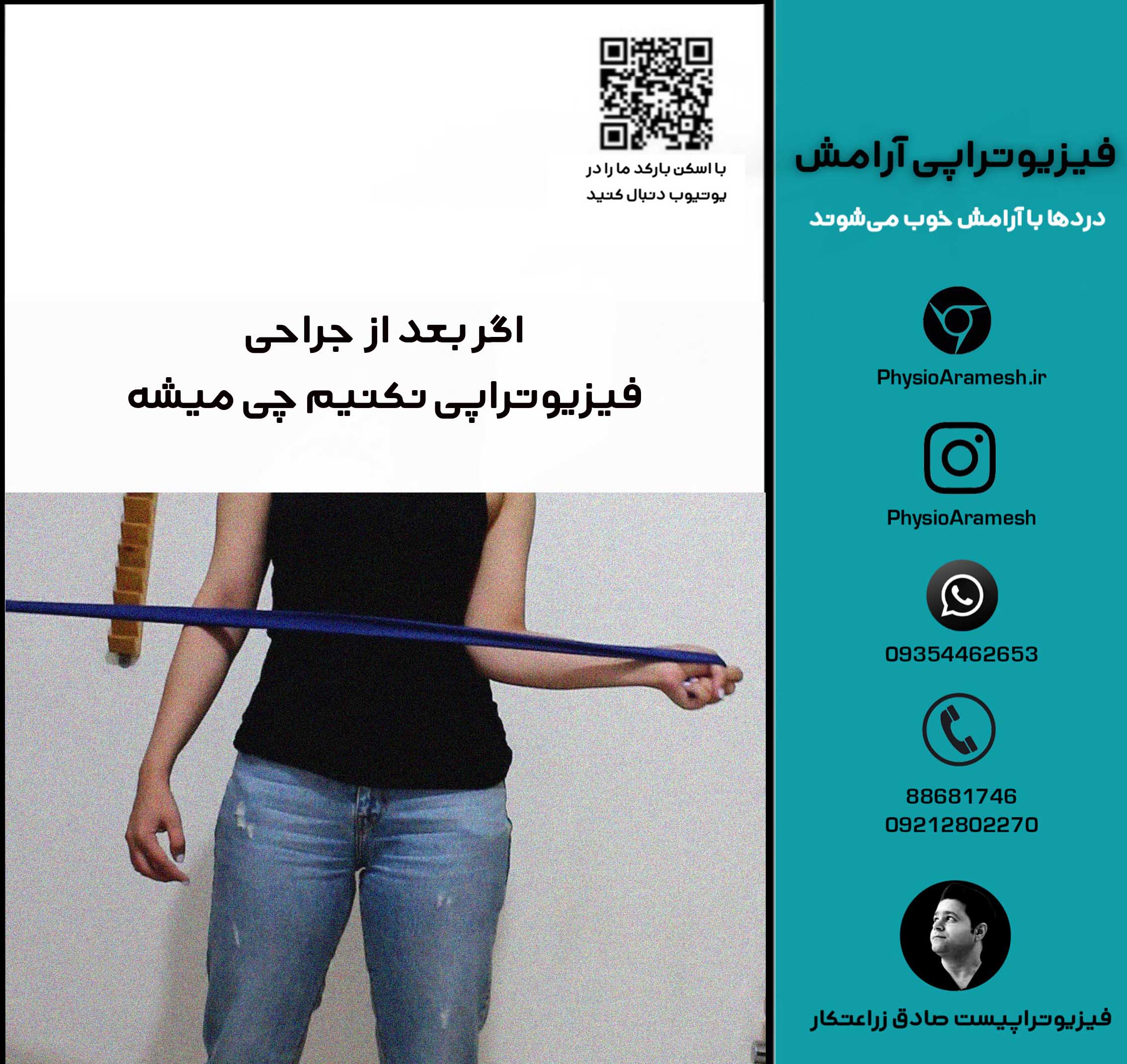 اگر بعد از  جراحی فیزیوتراپی نکنیم چی میشه